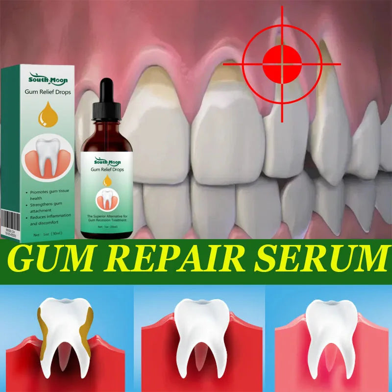 Gum Repair Serum Drops Relieve Receding Gum Periodontal Yellow Treatment Pharyngitis Oral Pain Cleaning Antibacteria Teeth Care