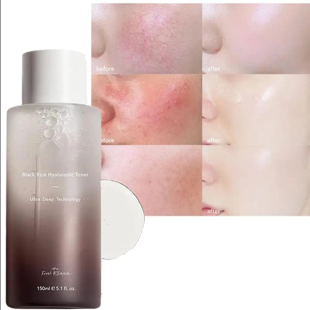 Haruharu Wonder Black Rice Toner Hyaluronic Acid Facial Essence Deep Moisturizing Facial Skin Essence Korean Skin Care Products