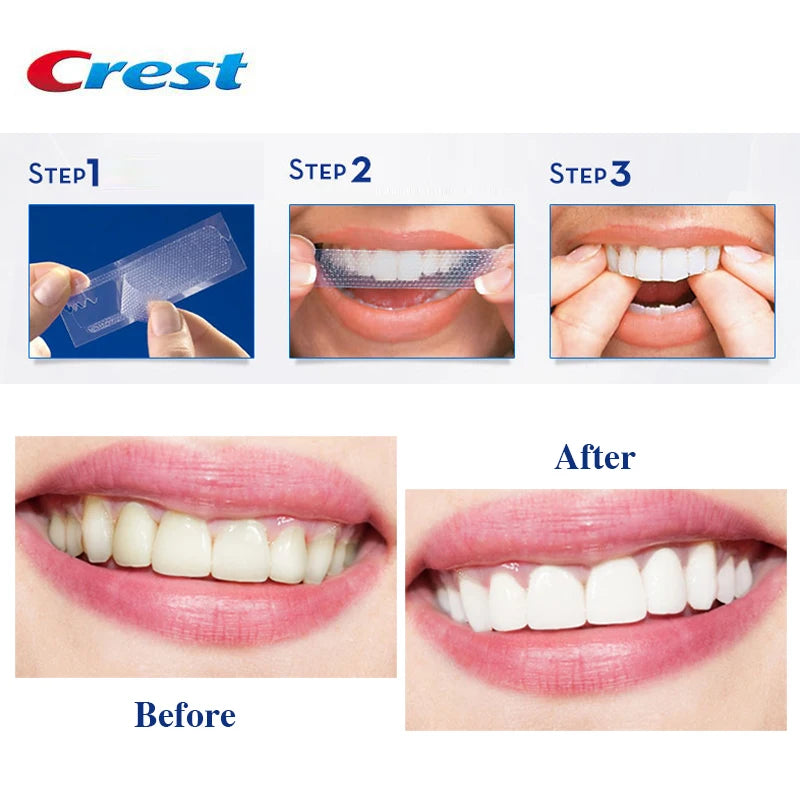 Crest 3D Whitestrips Dental Bleach Teeth Whitener Strips Glamorous White Crest Whitening Strips Teeth Whitening 5/7/14 Treatment