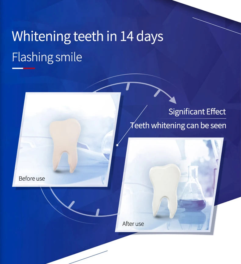 Crest 3D Whitestrips Dental Bleach Teeth Whitener Strips Glamorous White Crest Whitening Strips Teeth Whitening 5/7/14 Treatment