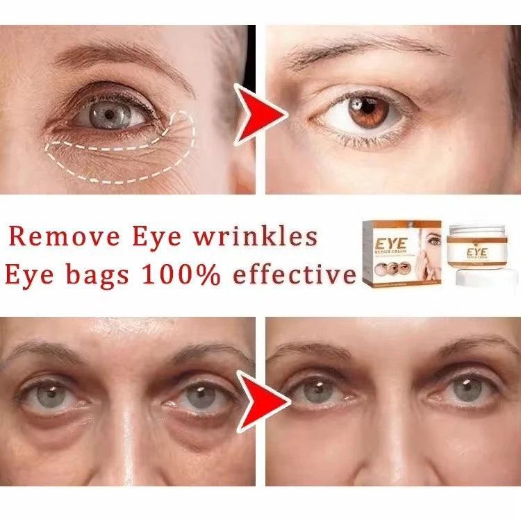 selling wrinkle removing eye cream, eye bags, dark circles, anti swelling, firming, brightening, fine lines, moisturizing tool