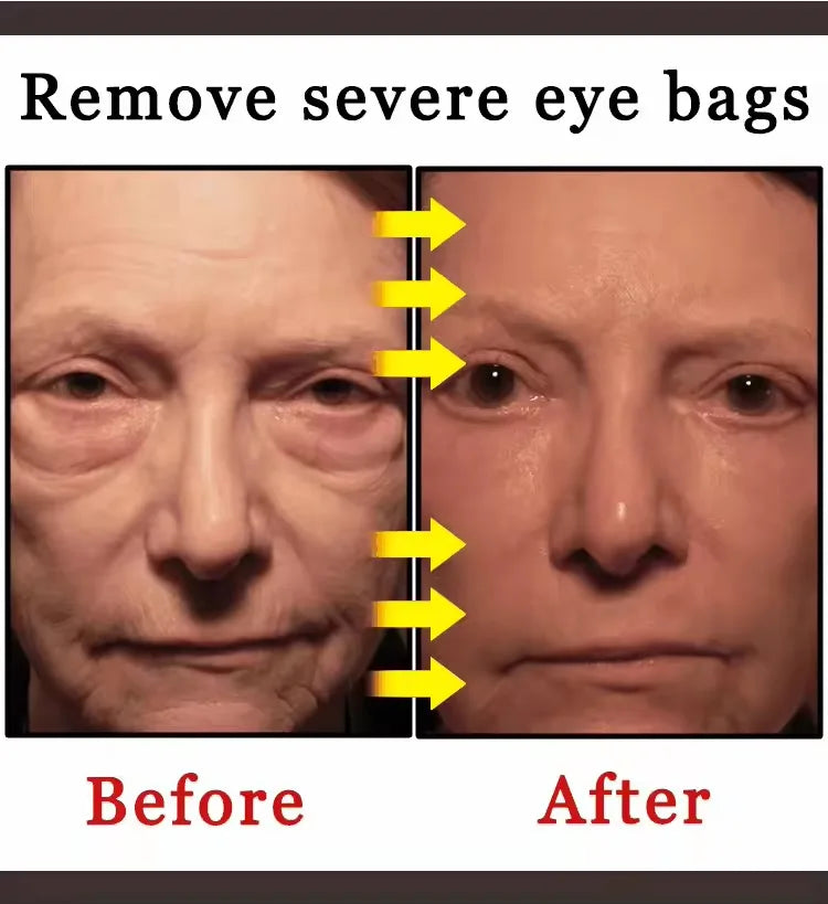 selling wrinkle removing eye cream, eye bags, dark circles, anti swelling, firming, brightening, fine lines, moisturizing tool