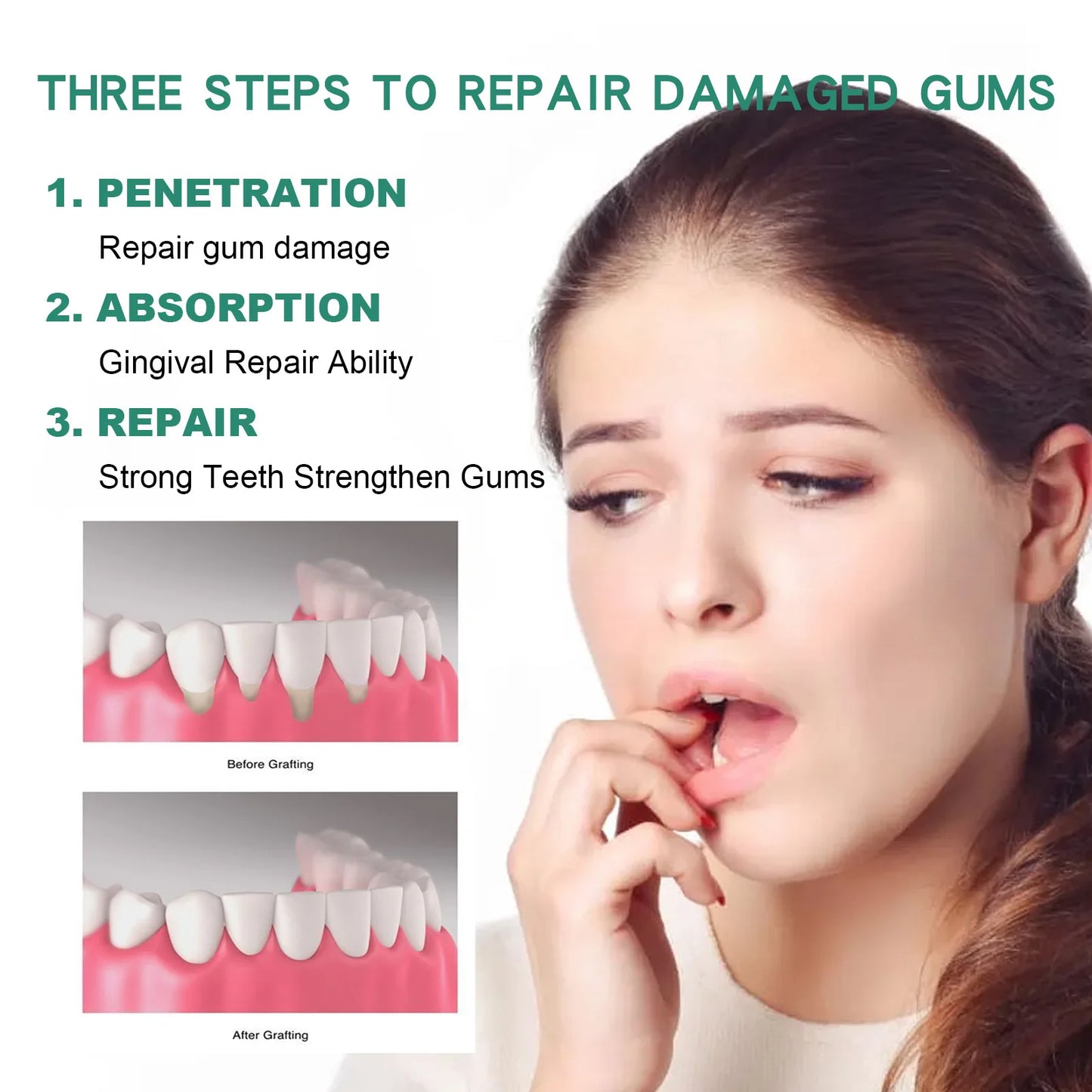 Gum Repair Serum Drops Relieve Receding Gum Periodontal Yellow Treatment Pharyngitis Oral Pain Cleaning Antibacteria Teeth Care
